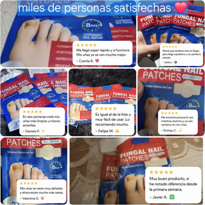 Parche FUNGAL NAIL® la mejor solución para los hongos