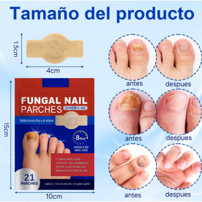 Parche FUNGAL NAIL® la mejor solución para los hongos